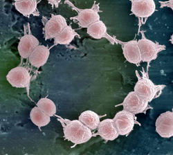 микробная теория инфекционных заболеваний