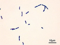 bacillus cereus