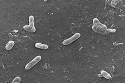 bordetella pertussis