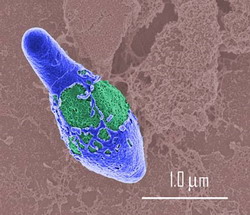 clostridium botulinum