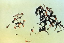 clostridium tetani