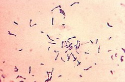 corynebacterium diphtheriae