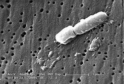 klebsiella pneumoniae