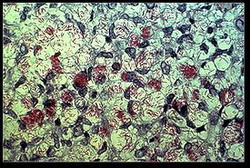 mycobacterium leprae