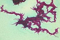 mycobacterium tuberculosis