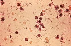 shigella dysenteriae